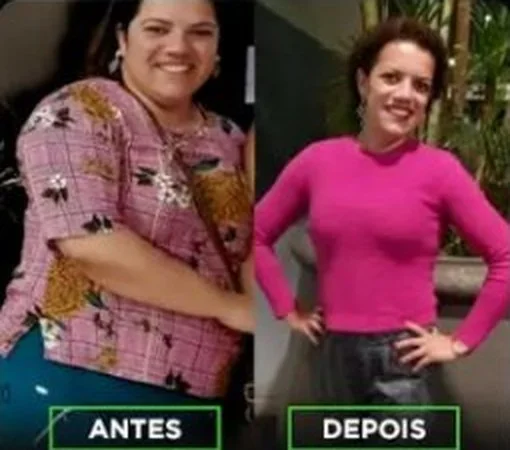Antes e depois de Aleksandra